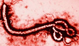 伊波拉病毒 在线观看,在线观看揭示致命疫情真相