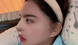 韩安冉最新爆料整形,揭秘最新爆料背后的真相