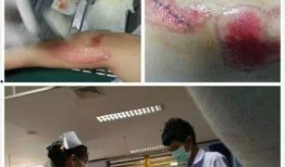 娱乐圈近期爆料谁出车祸,某明星不幸遭遇车祸，伤情严重！